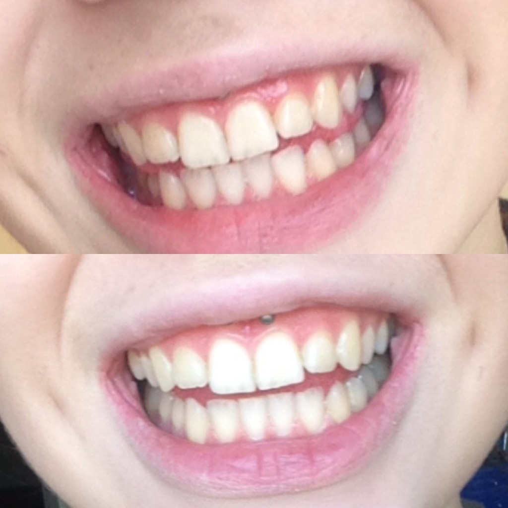 Top = Before Bottom= After 