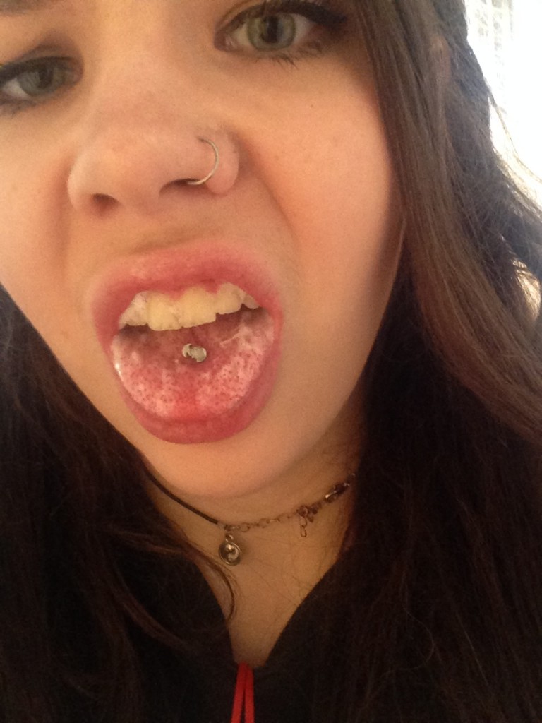 gross