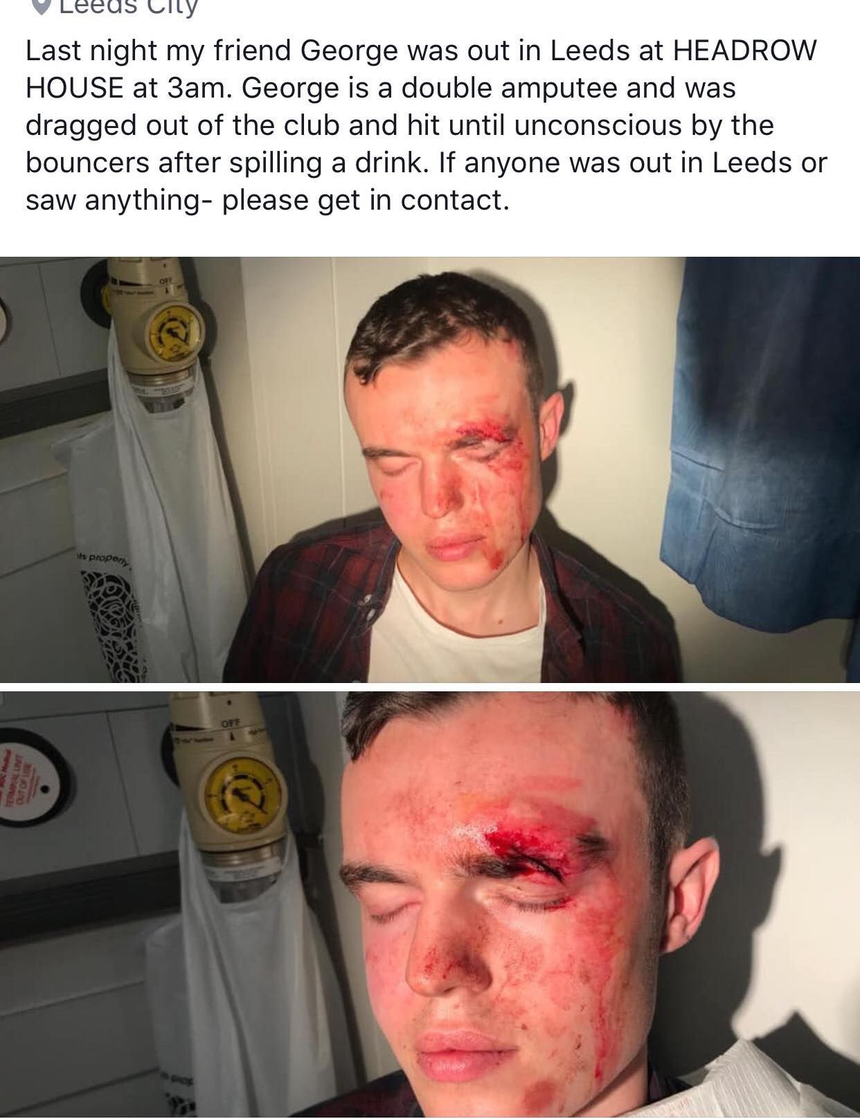 Image may contain: Face, Injury, Person, Human, Head