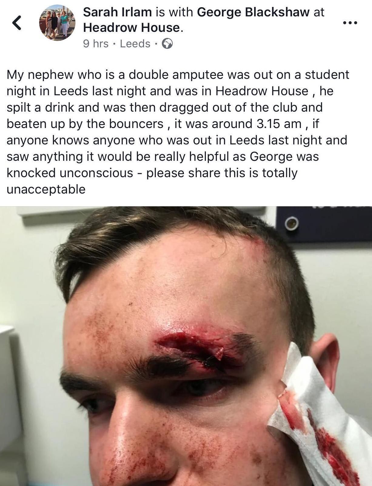 Image may contain: Injury, Head, Face, Person, Human