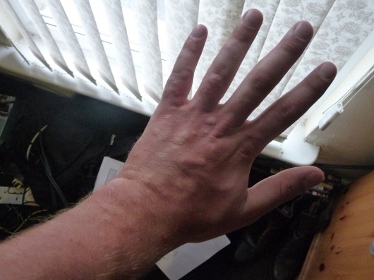 If you don't want to look like a leper, use Resident Review