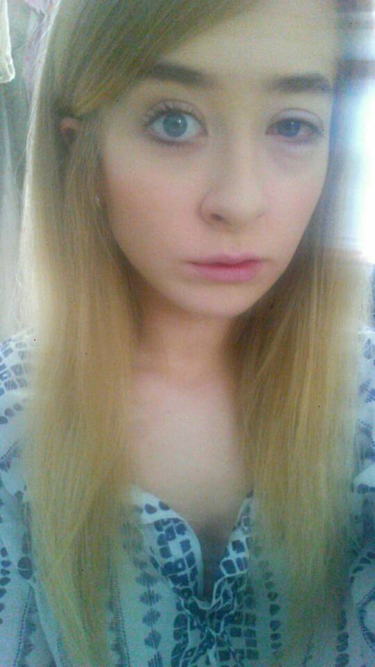 black eye