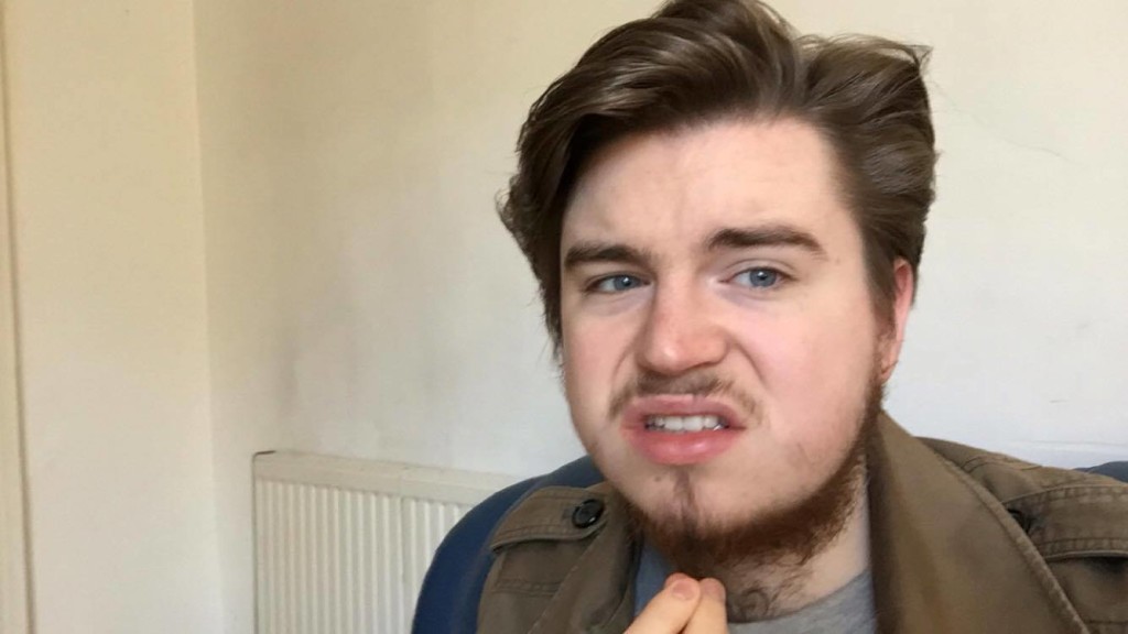 beard chinstrap neckbeard