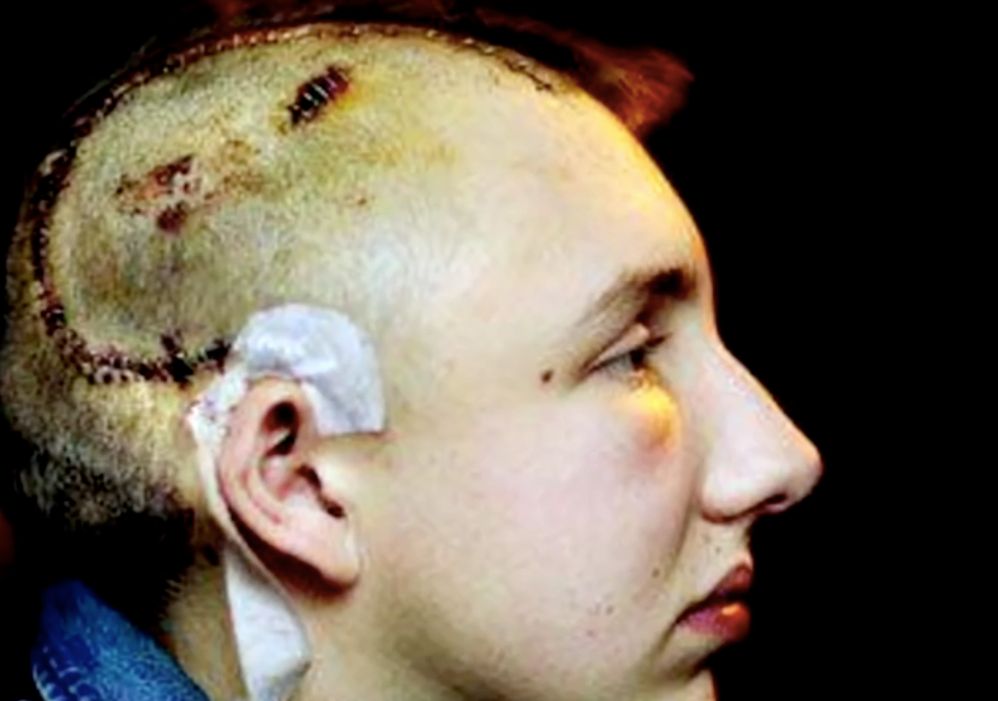 Image may contain: Skin, Person, Human, Face, Head
