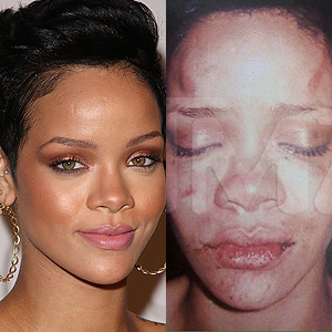 Rihanna beaten