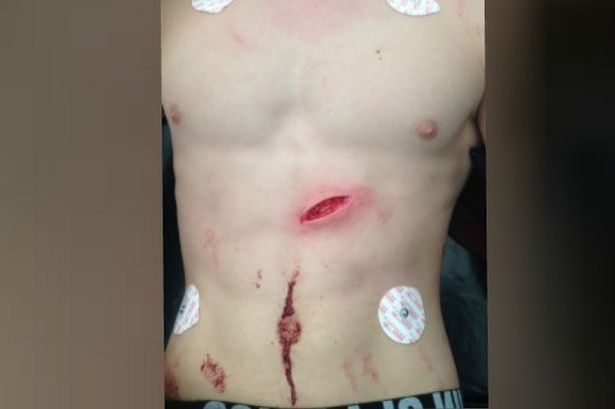 Police released this image of Lewis' injuries.