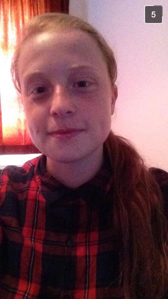 Frances received verbal abuse because of her hair colour