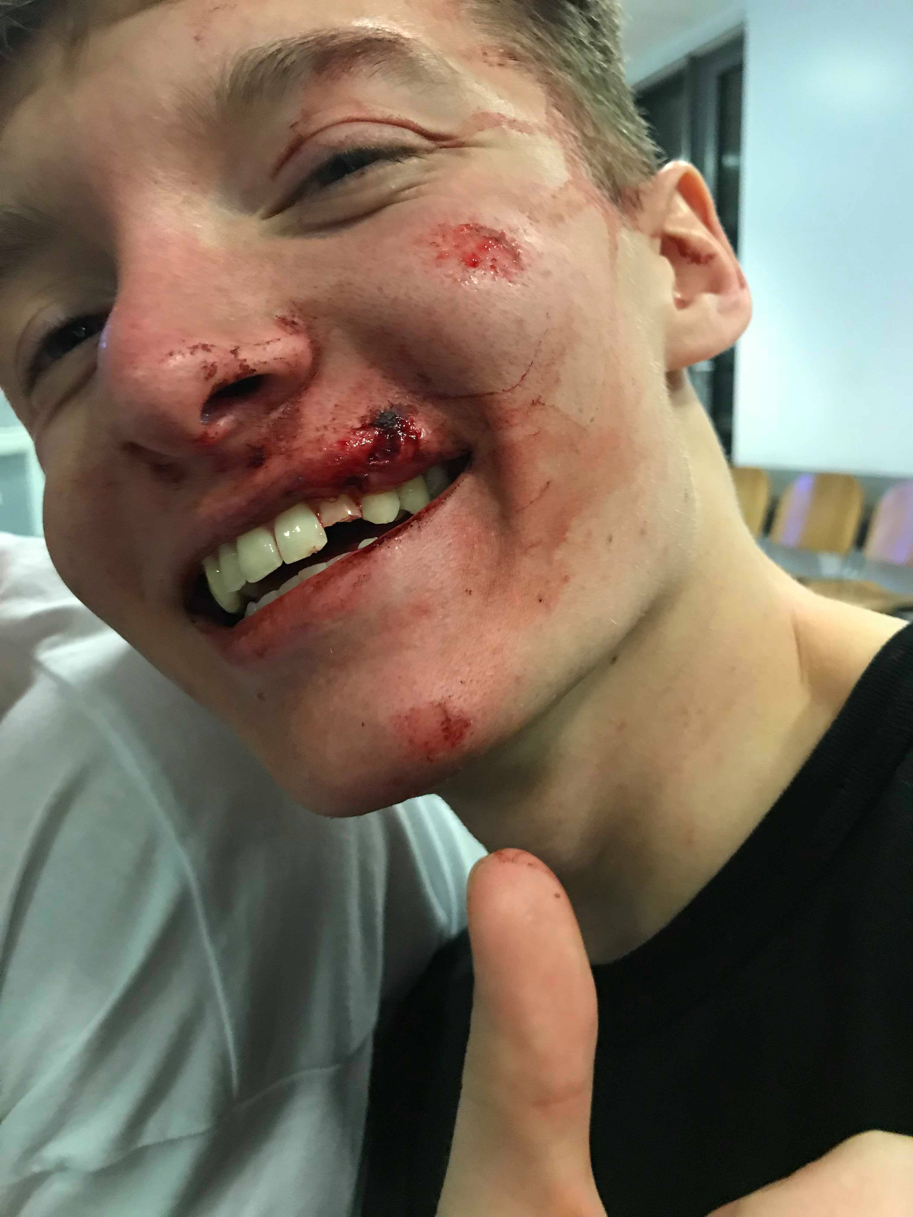Image may contain: Injury, Finger, Lip, Mouth, Face, Human, Person