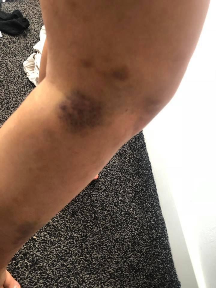 Image may contain: Knee, Human, Person, Arm