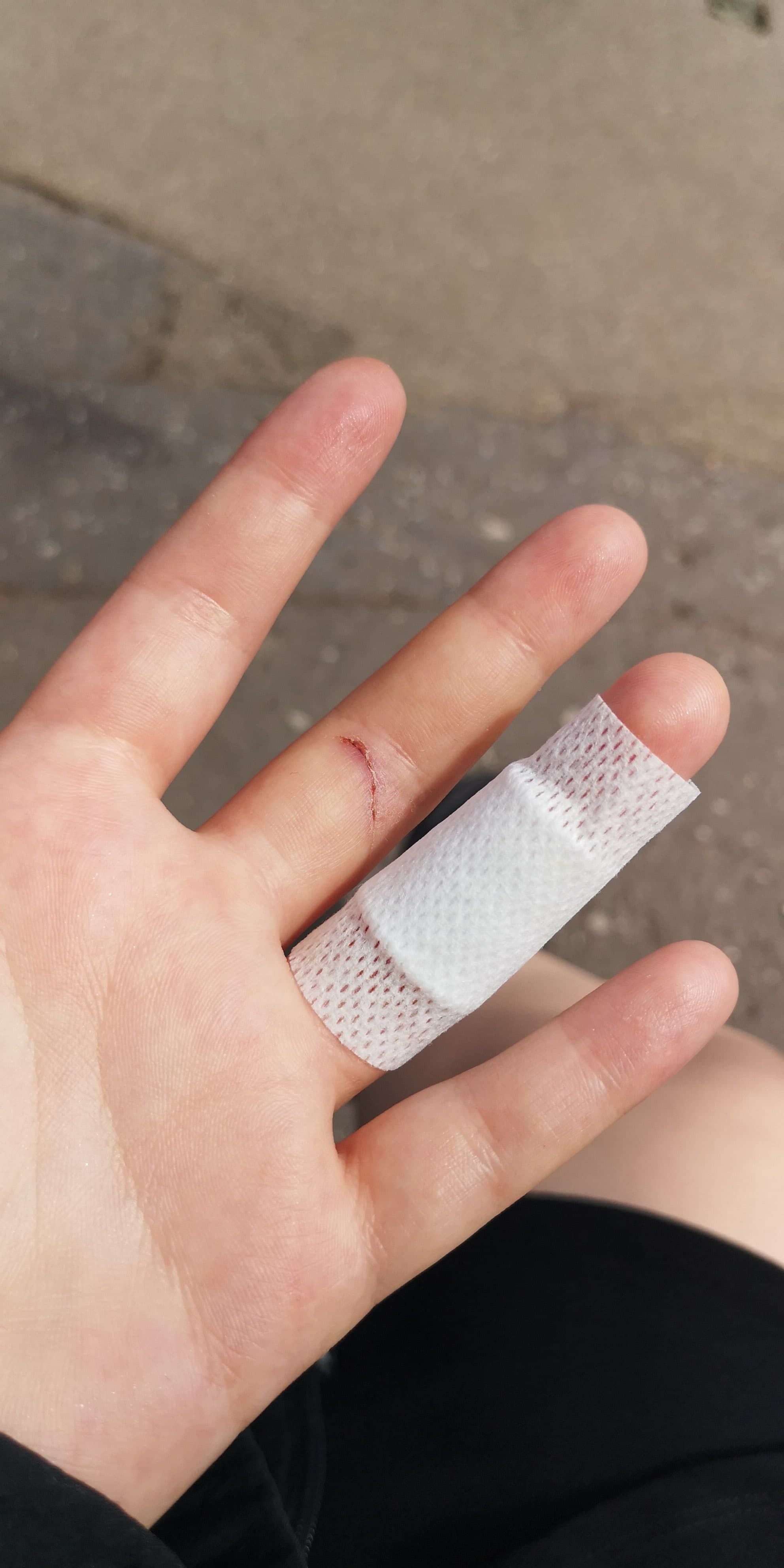 Image may contain: Nail, Hand, Finger, Bandage, First Aid, Person, Human