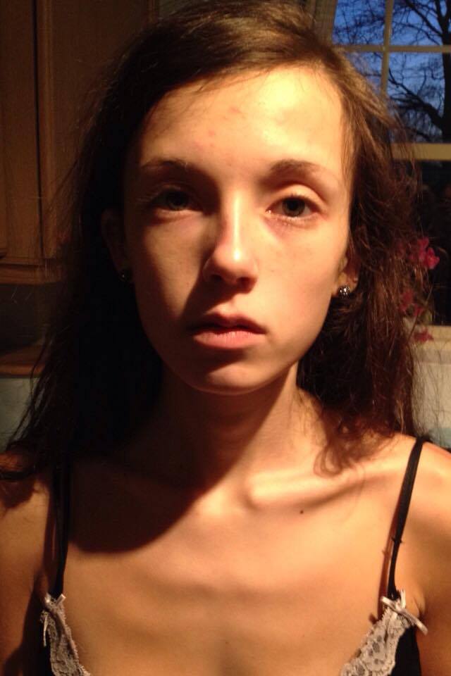 I literally look dead