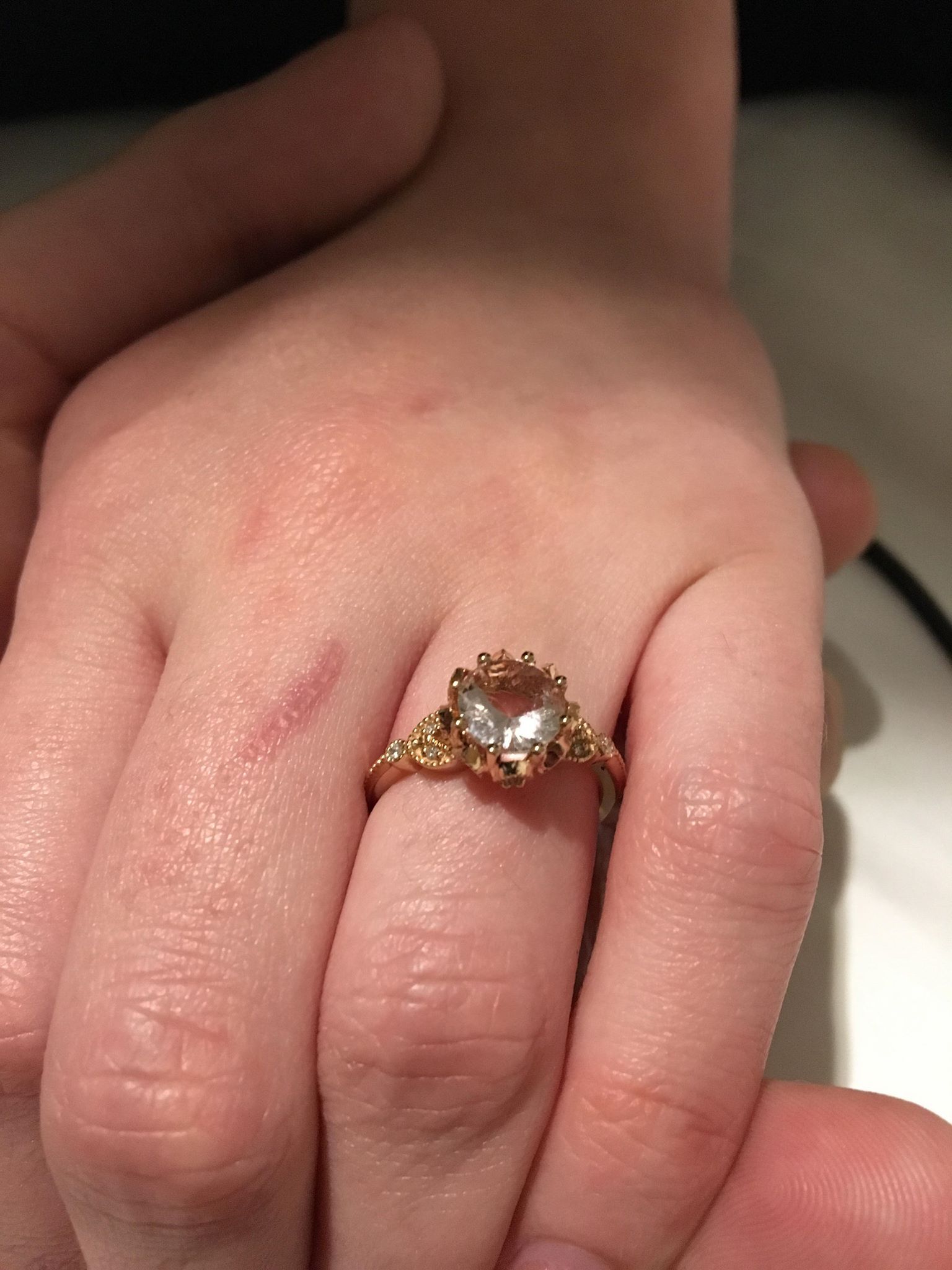 Image may contain: Nail, Hand, Finger, Ring, Jewelry, Accessory, Accessories, Human, Person