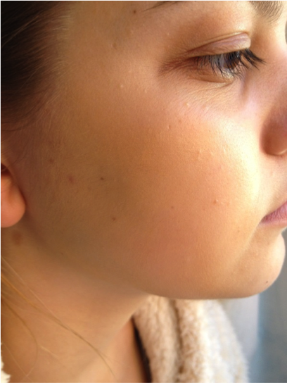 nars2
