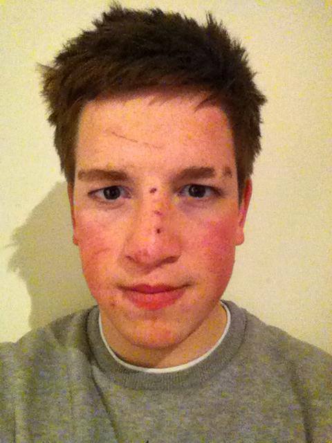 after face