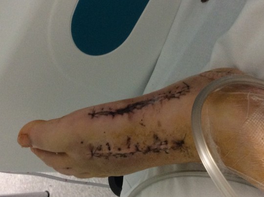 injury