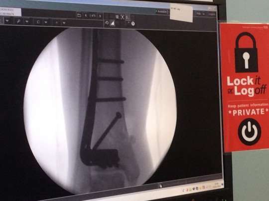 x ray