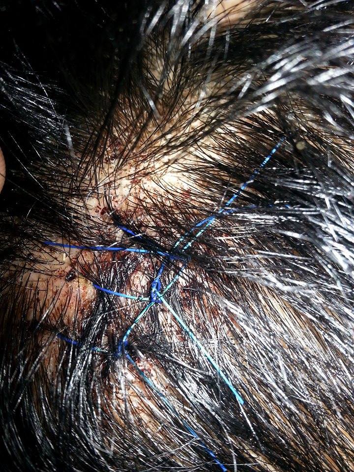 Close up of David's head a week later.