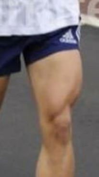 quads