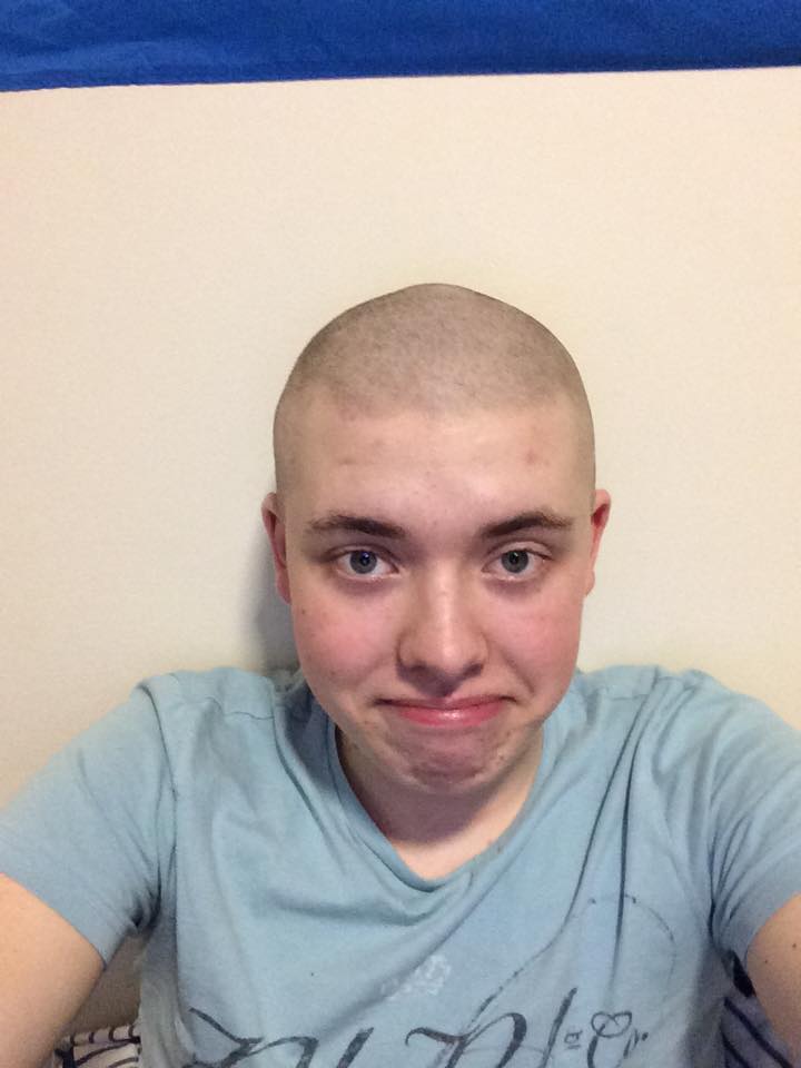 These hairlines aren't loyal.
