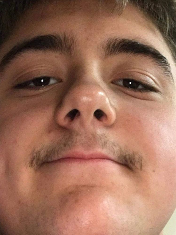 Image may contain: Mustache, Mouth, Lip, Skin, Jaw, Head, Human, Person, Face