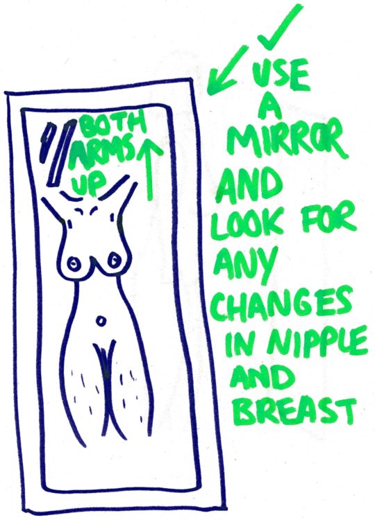 Signs of Breast Cancer