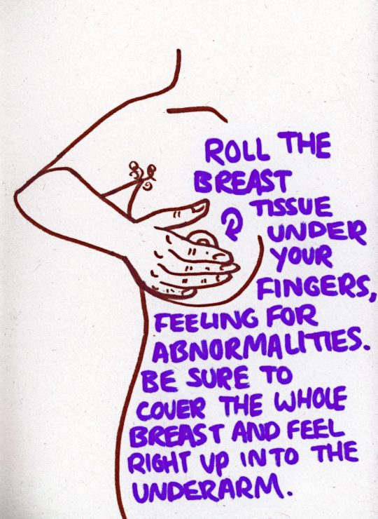 Signs of Breast Cancer