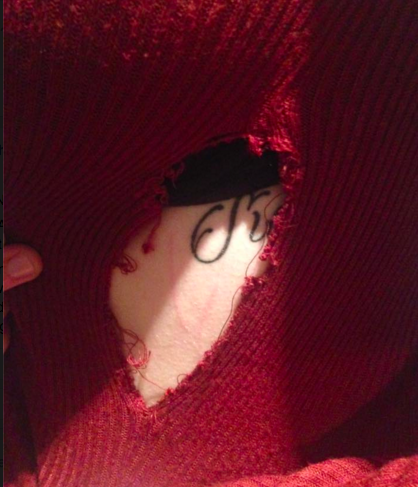 She also had nail marks down her side 
