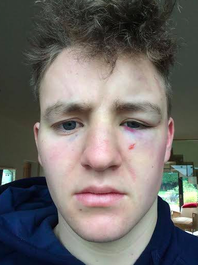 x