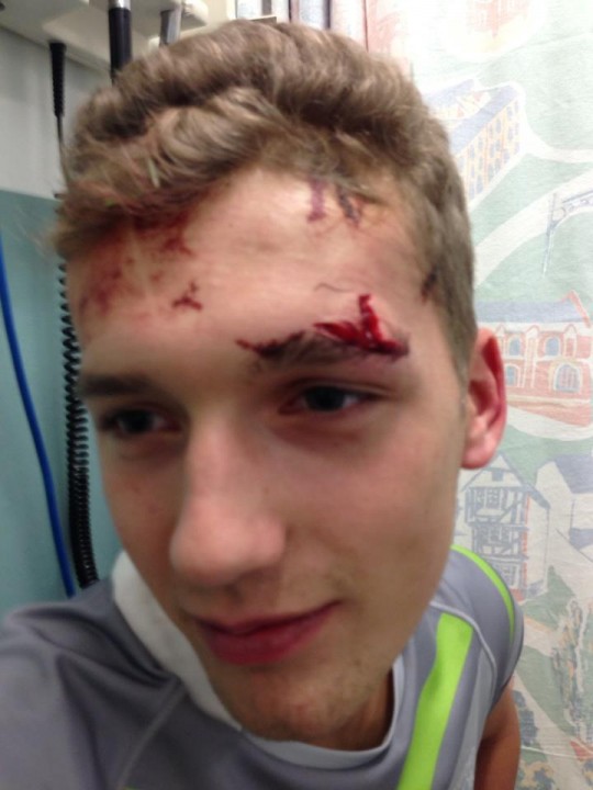 A cut above (the eye)