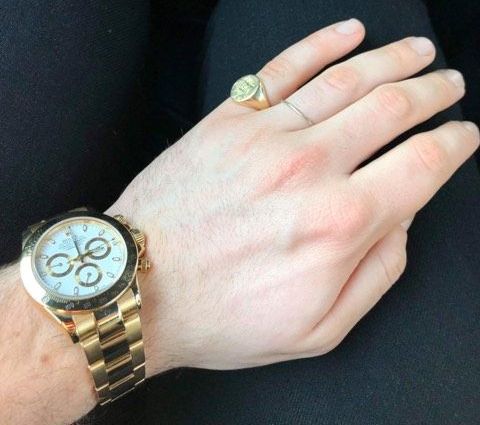 Image may contain: Wrist, Hand, Wristwatch, Person, Human