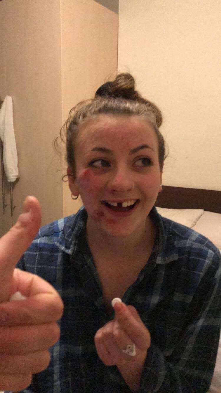 Image may contain: Thumbs Up, Finger, Person, Face, Human