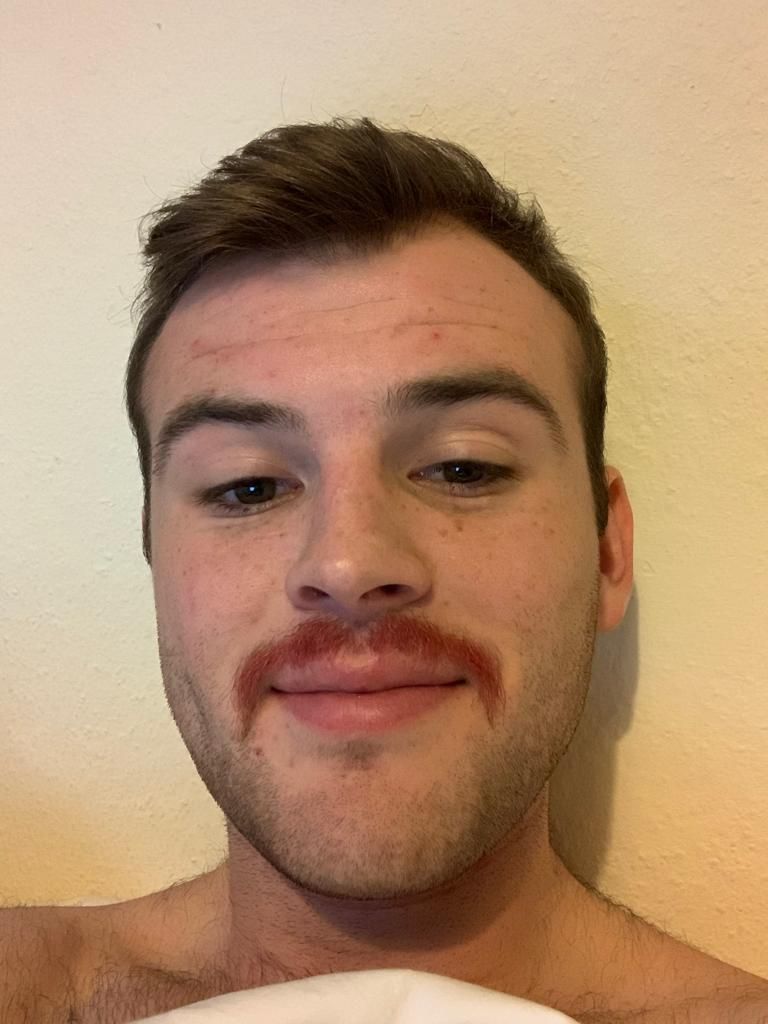 Image may contain: Skin, Selfie, Man, Photo, Portrait, Photography, Head, Person, Human, Face