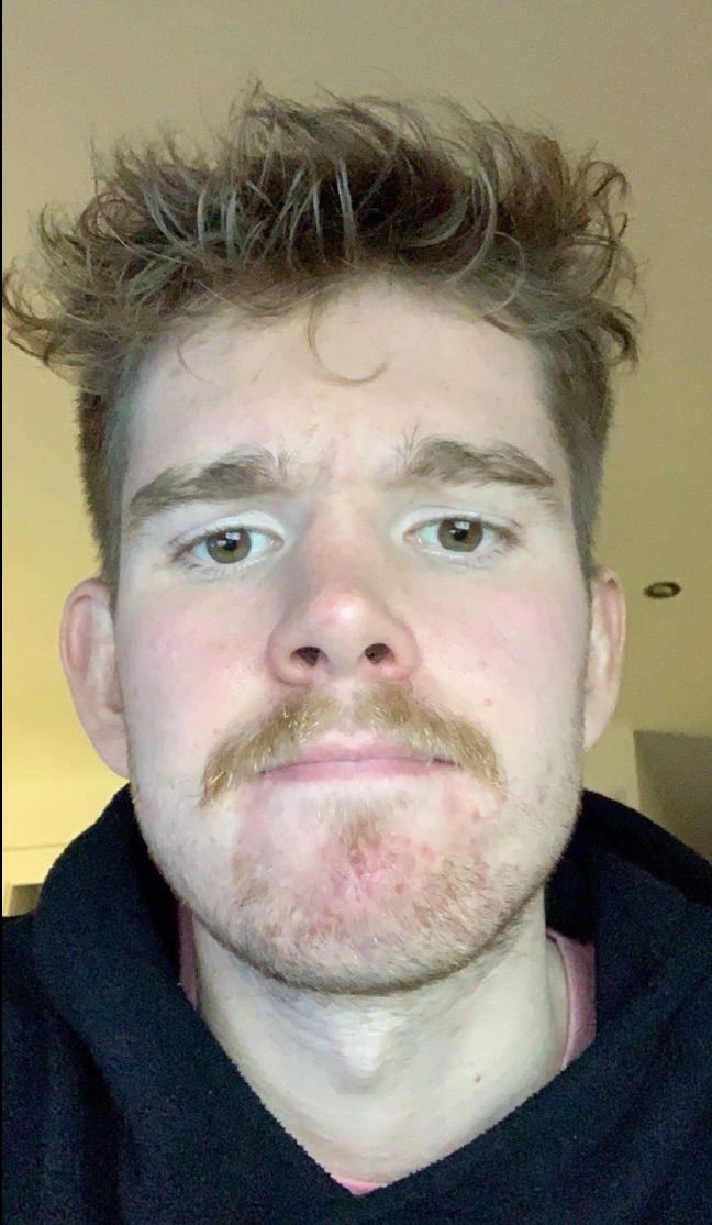 Image may contain: Man, Mustache, Beard, Face, Human, Person