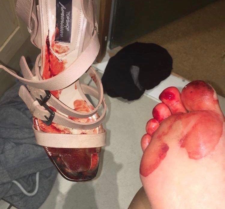 Image may contain: Shoe, Pet, Animal, Mammal, Cat, Sandal, Person, Human, Toe, Footwear, Apparel, Clothing