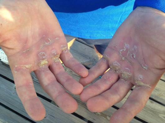 ‘I wouldn’t want to rub lotion into someone’s back right now, I’d probably cut them’