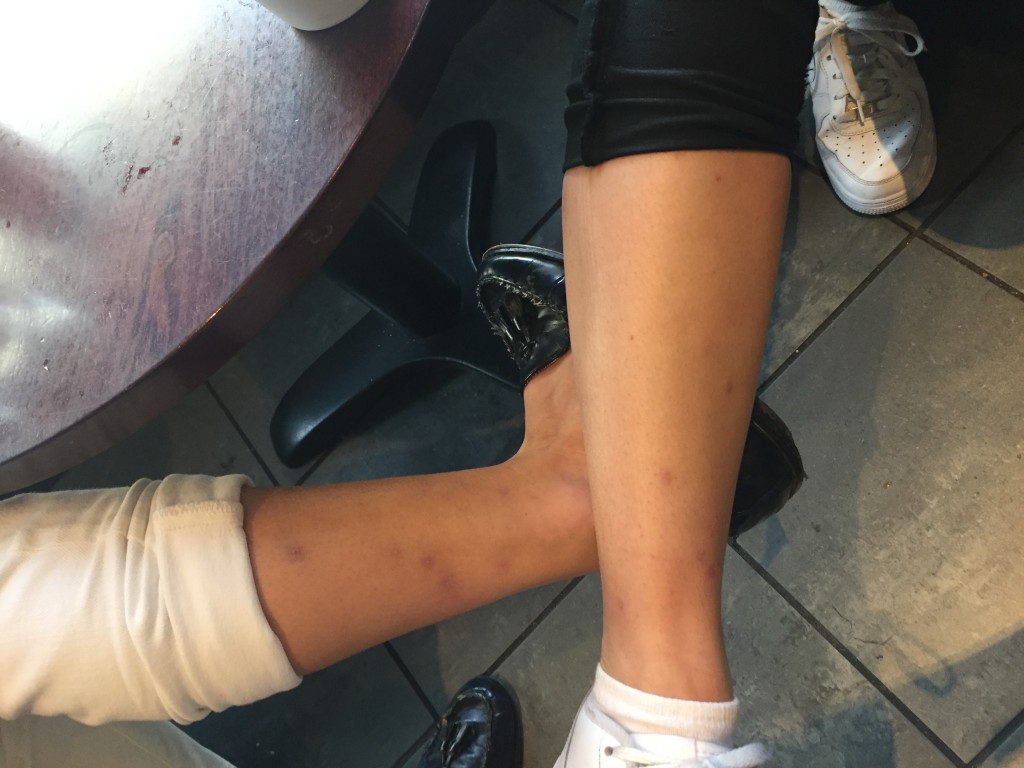 It's been three weeks and they're still covered