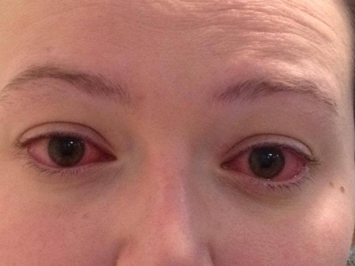After I lost my eye sight