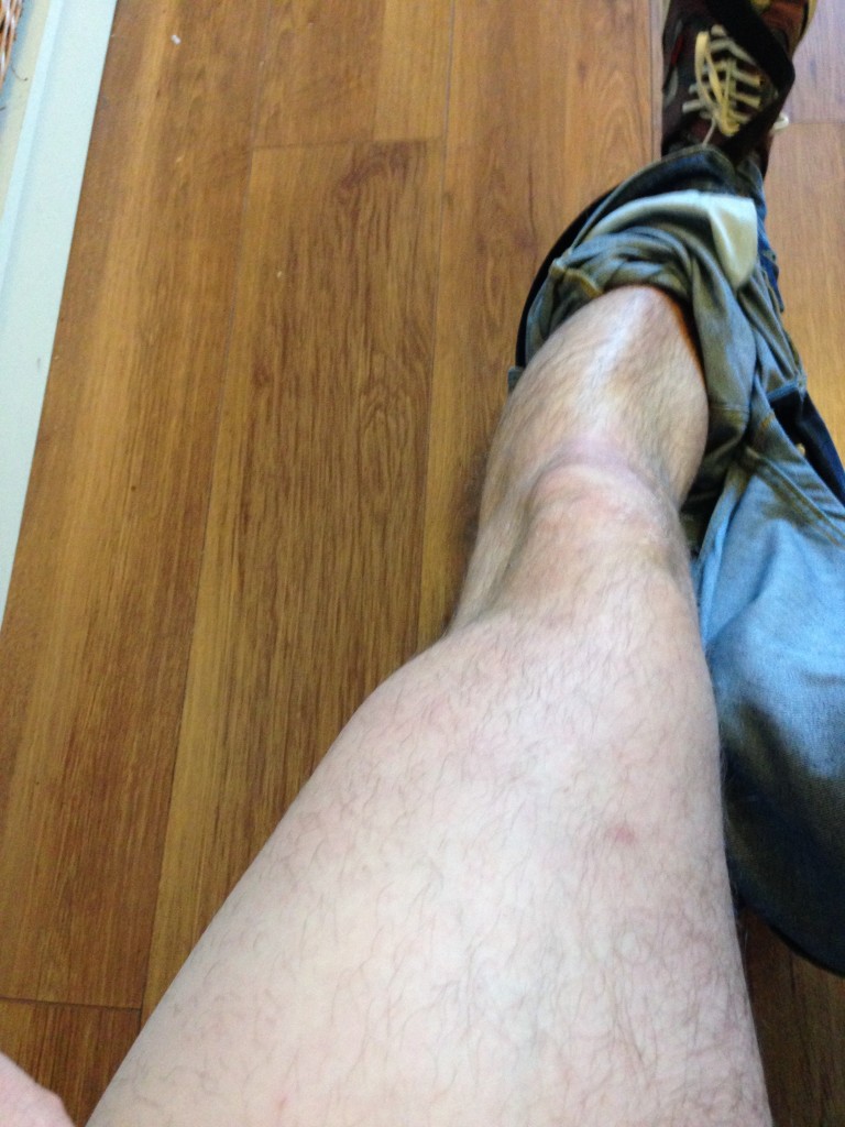 A leg
