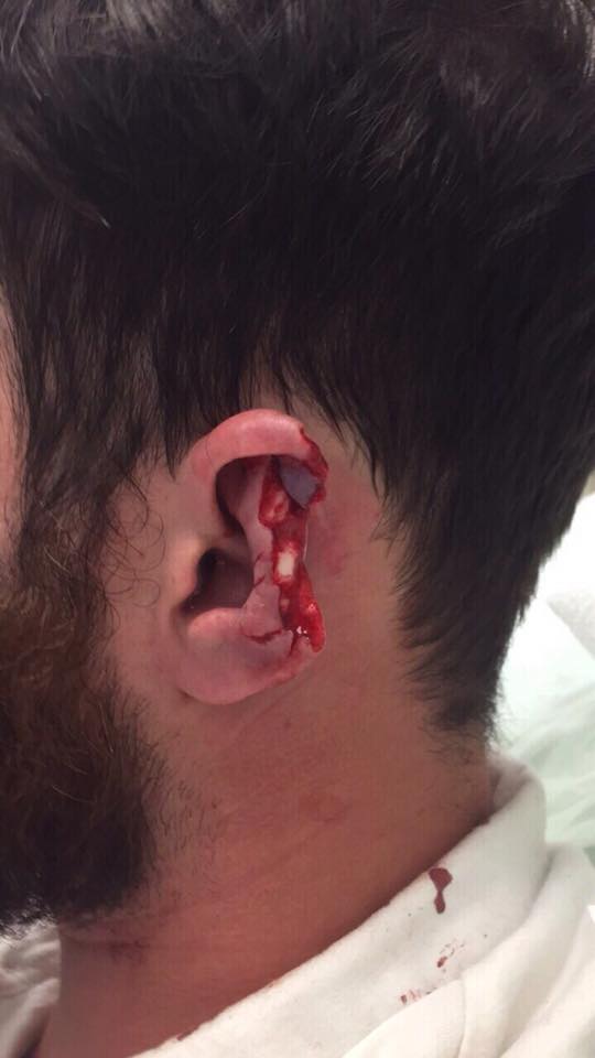 Ear