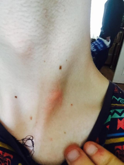 Poor Oren, the victim of this brutal attack.