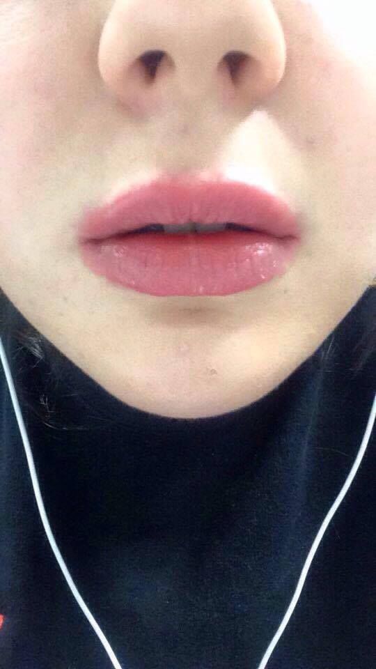 bio lips 2