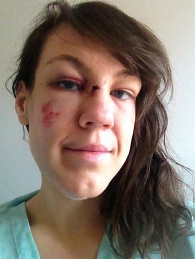 Teddy Hall student posted a selfie of her injuries to raise awareness of her attack