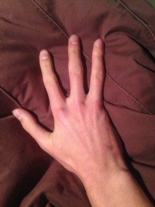 Here's the hand. Spot the phantom.