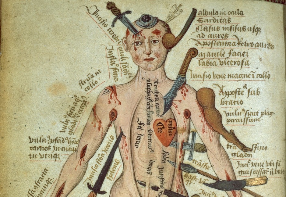 wound-man-e1402772323700
