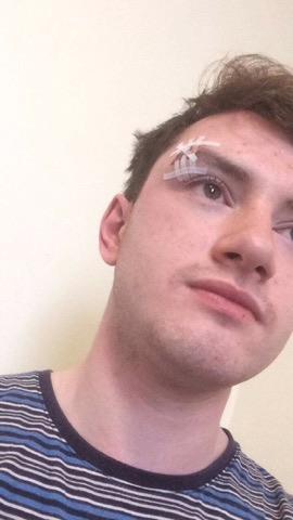 The haunted face of a man who was kicked out of Spoons, then fell on his face