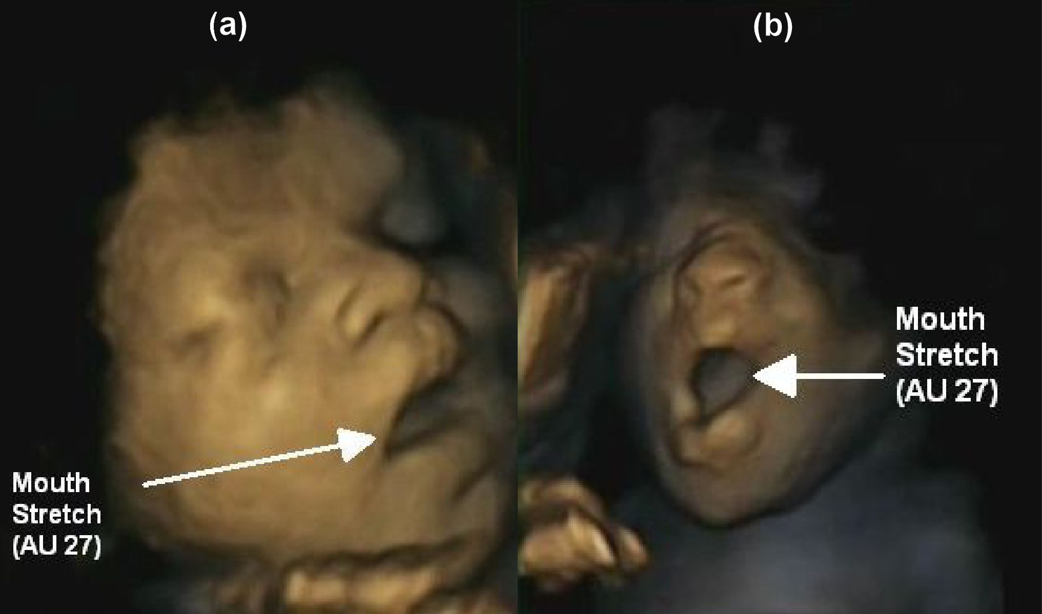 Double image
