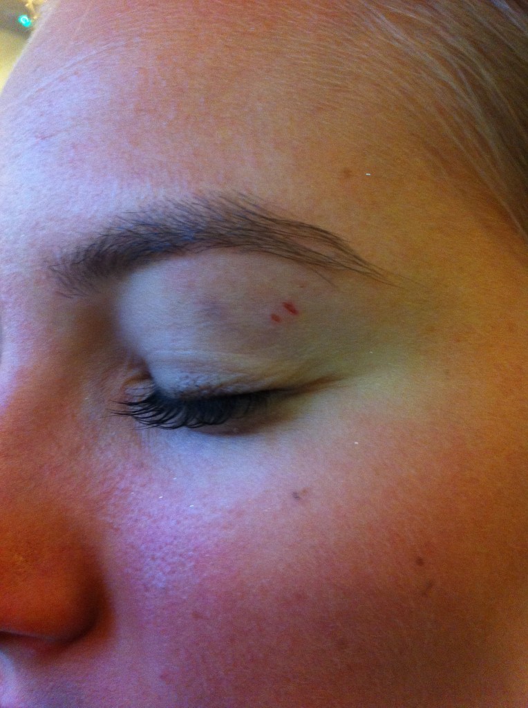 Ouch.