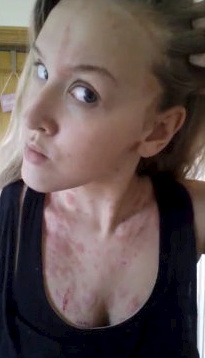 swns_skin_bateman_26