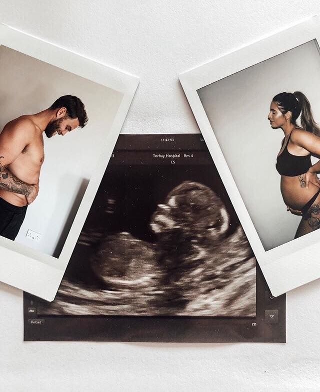 Image may contain: Jess Shears pregnant, Jessica Shears, Dominic Lever, Jess and Dom, Love Island, 2017, baby, pregnant, baby scan, Sport, Sports, Person, Human