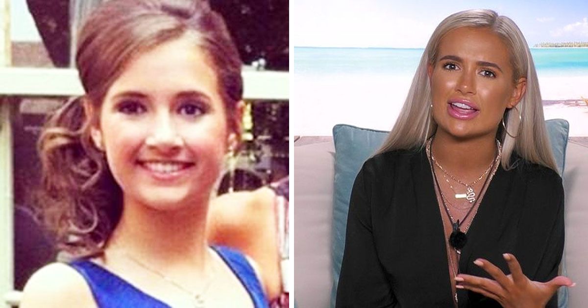 Image may contain: Molly-Mae transformation, Love Island, Molly-Mae Hague, before, after, villa, old, new, transformation, glow up, surgery, lip filler, lips, filler, tan, cosmetic, plastic, work done, teeth, veneers, glow up, Photo, Photography, Portrait, Dimples, Necklace, Accessories, Jewelry, Accessory, Smile, Woman, Female, Human, Face, Person